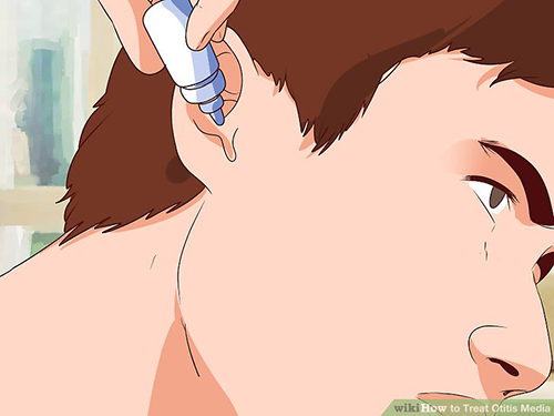 علاج التهاب الأذن الوسطي